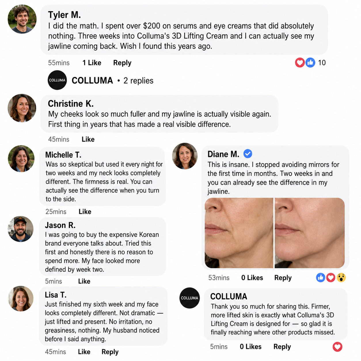 Colluma Lifting Cream — No Needles. Just Results.