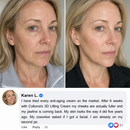Colluma Lifting Cream — No Needles. Just Results.