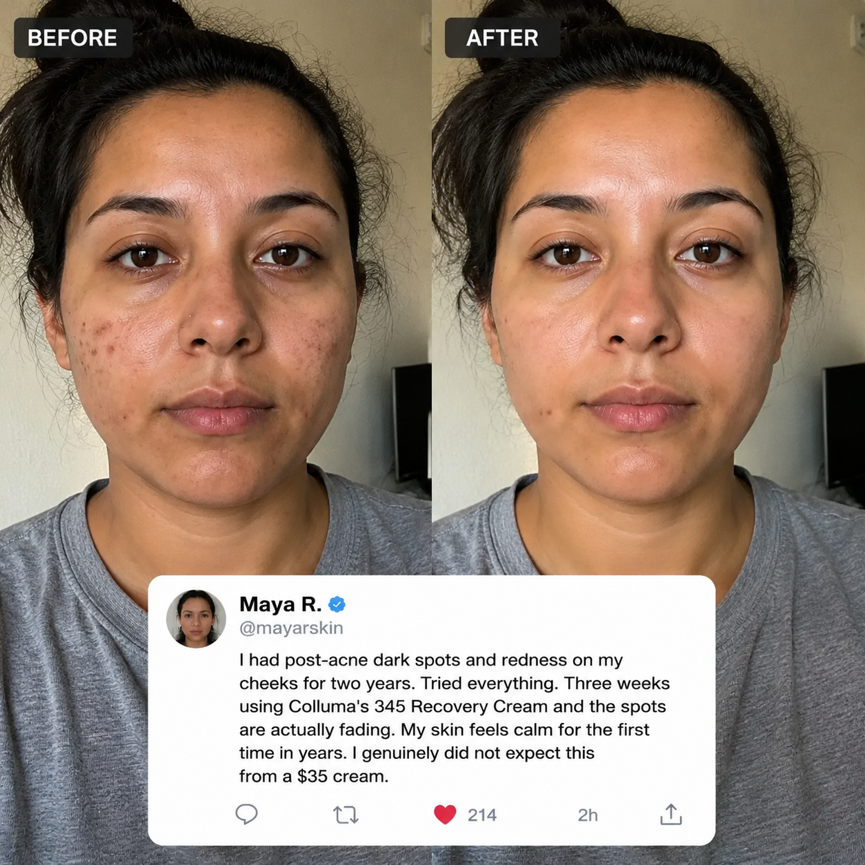 Colluma 345 Recovery Cream — No Filters. Just Skin.