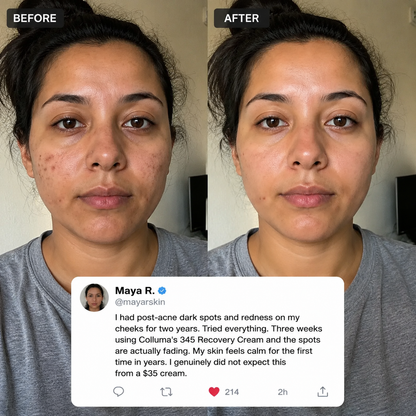 Colluma 345 Recovery Cream — No Filters. Just Skin.