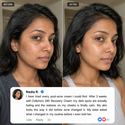 Colluma 345 Recovery Cream — No Filters. Just Skin.